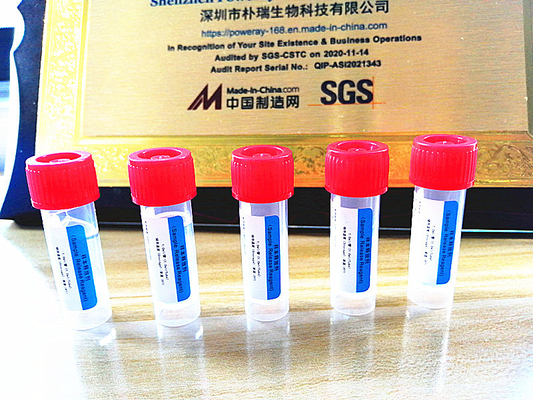 Domowy zestaw testowy PCR z aprobatą SGS Ekstrakcja DNA i RNA dla Covid-19